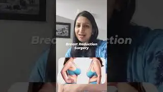 Solution to heavy breast problems....@drnupuraggarwal4355