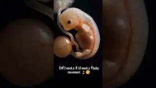 Human baby #lifegrow #subscribers #like