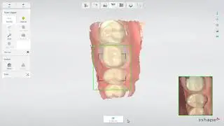 3Shape TRIOS   Trim and Lock Tools