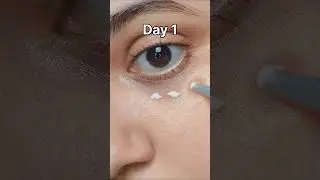 ✨ 14 Days Eye Cream Transformation | Mary & May Eye Cream Review 🌿 @mary&may #shorts