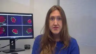 TGR5 contributes to glucoregulatory improvements after VSG in mice