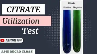 All about Citrate test | How to read Citrate test ?