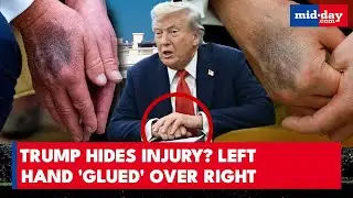 Prez Trump&rsquo;s HIDDEN Injury? Left Hand &lsquo;GLUED&rsquo; Over Right Raises Serious Concerns Amid Kirk Tragedy