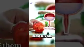 Tomatoes  The Prostate Health Powerhouse You Need to Know About