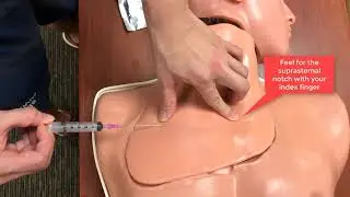 Central Venous Catheterization - subclavian vein