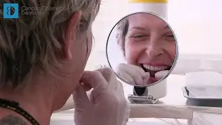 Snap in Denture review TEST and results in Cancun Cosmetic Dentistry! Have a Strong Teeth Again