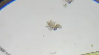 Tardigrade
