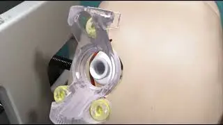 MRI DBS Surgery using ClearPoint Neuro platform