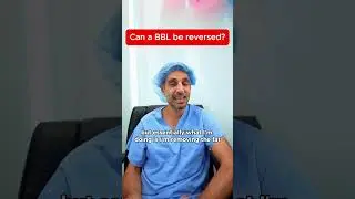 Can a BBL be reversed? #bbl #reversebbl #newlifeplasticsurgery