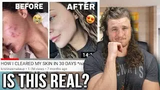 HOW I CLEARED MY SKIN IN 30 DAYS | MY RESPONSE @kristinaxmakeup