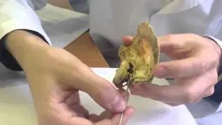 Canalis musculutubarrus