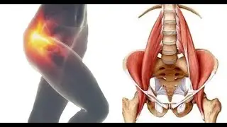 Hip Flexor Injury & Snapping Hip Syndrome