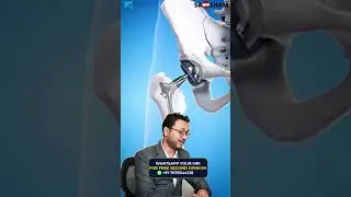 Which Implant is Best for Hip Replacement? | Dr. Debashish Chanda