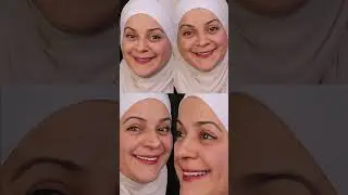 ✨Before and after case✨
