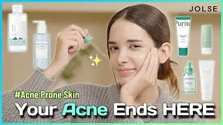 Skincare Routine Dermatologists Fear For Acne-Prone Skin 🔍