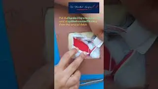 SurgiSphere: 3.  Inguinal Hernia Repair on Synthetic Model Part 4