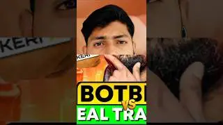 Lavish Chaudhary BotBro Scam Exposed | Botalpha TLC Coin 2.0 Review | Forex Trading Tips