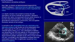 échographie chez le sujet âgé