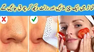 BlackheadRemoval|TomatoSkincare|DIYBeauty|TomatoMask|AcneTreatment