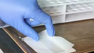 Slide Preparation Wet Mount of Human Mouth Epithelial cells and Onion Epidermal cells