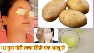 10 गुना गोरी त्वचा सिर्फ़ एक आलू से: Dark circles || Dark spots || Skin whitening And Pigmentation
