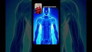 CRT-D Device Implantation | Dr. Rajiv Kharwar | Sunshine heart center  Surat