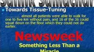 New Knee Arthritis Pain Cure | Sibia medical centre