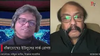 বাঁকাচোখেঃ ইউনূসের সার্ক রোগ!!