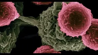 New Australian research offers hope for rare blood cancer patients