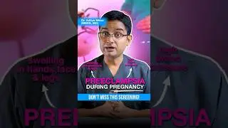 Pregnancy Swelling Explained! Preeclampsia Signs & Prevention Tips.