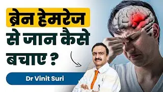 ब्रेन हेमरेज से जान कैसे बचाए ? | Subdural Hematoma: Brain Hemorrhage Causes, Symptoms & Treatment