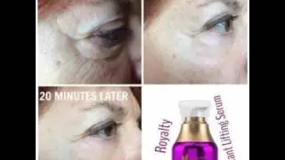 Younique Instant Lifting Serum Results!
