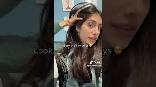 How to Cure Traction Alopecia, Told by a Pediatrician! | Dr. Amna Husain #shorts #tractionalopecia