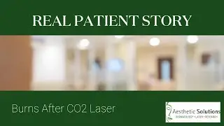 Real Patient Story: Facial Scarring after CO2 Laser