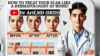 HOW TO TREAT YOUR SCAR AT HOME @DrArifMDDermatologist #scar #scarcream #scartreatment