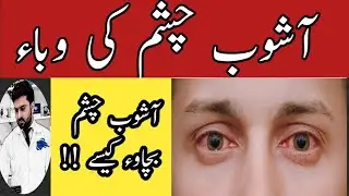 Ashob E Chasm ka ilaj | Pink eye ,viral conjunctivitis |eye Flue symptoms treatment in Urdu