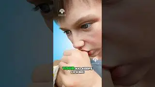 What Does Thumb Sucking Do to kids Teeth 😮  #openbite #shorts  - Creativelearning3d