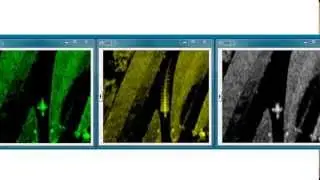 SkyRadar Drone Detection