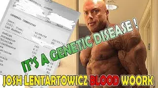 Josh Lenartowicz TELLS US what is wrong with his health