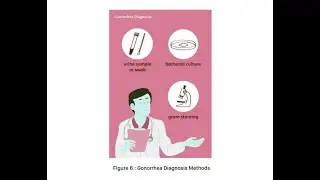 Screening Tests for Gonorrhea