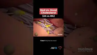 Bad vs. Good Cholesterol