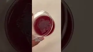 beauty blender germs  #biology #microbiology #lablife #microscope #science #thesciencelife