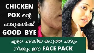 Amazing DIY Remedies for Chicken Pox Marks | Natural Tip for removing blackmarks on face