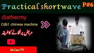 shortwave diathermy | practical | diathermy machine | swd electrotherapy |#shortwave #physiotherapy