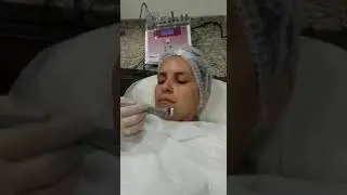 Stimulus Face HTM, conjugado facial 9 em 1: Ioniza&ccedil;&atilde;o