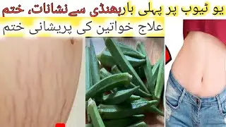 life hacks💯👌 Amazing🤩 and   Post Pregnancy Stretch Marks | Remove Stretch Marks