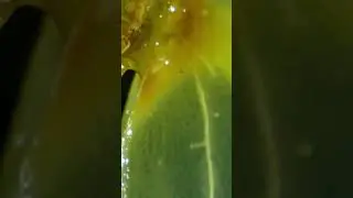 This juicy structure under the microscope will surprise you 👀