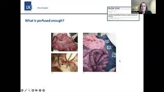 FGS in Acute and Chronic Ischemia of the Small Intestine ::: Anna Dupree, MD