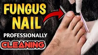 Informative Normally Trimmings nails 🔥/  professionally / Footcare33
