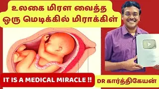 மருத்துவ  அற்புதங்கள் ||  medical miracle story of pregnancy  part 2 ||  dr karthikeyan